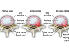 H2HT Disc Article 2024 Dr Jess Harvey 3